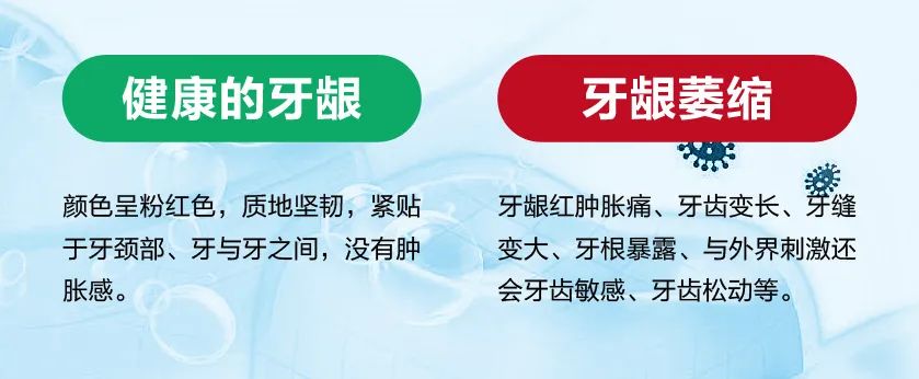 如何判斷自己是否有牙龈萎縮的症狀呢？其實通過對比就能發現